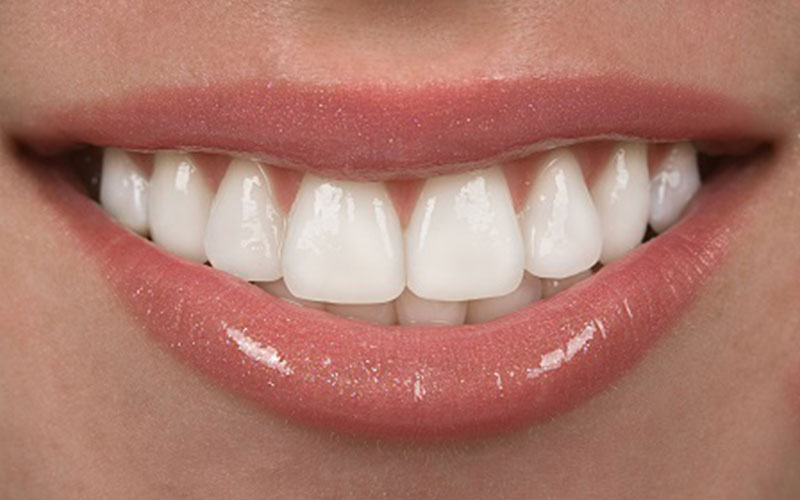 Smile Confidently with Porcelain Veneer