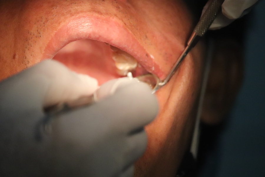 Get a Brand New Smile in Just 24 Hours: The Magic of Same Day Dental Implants
